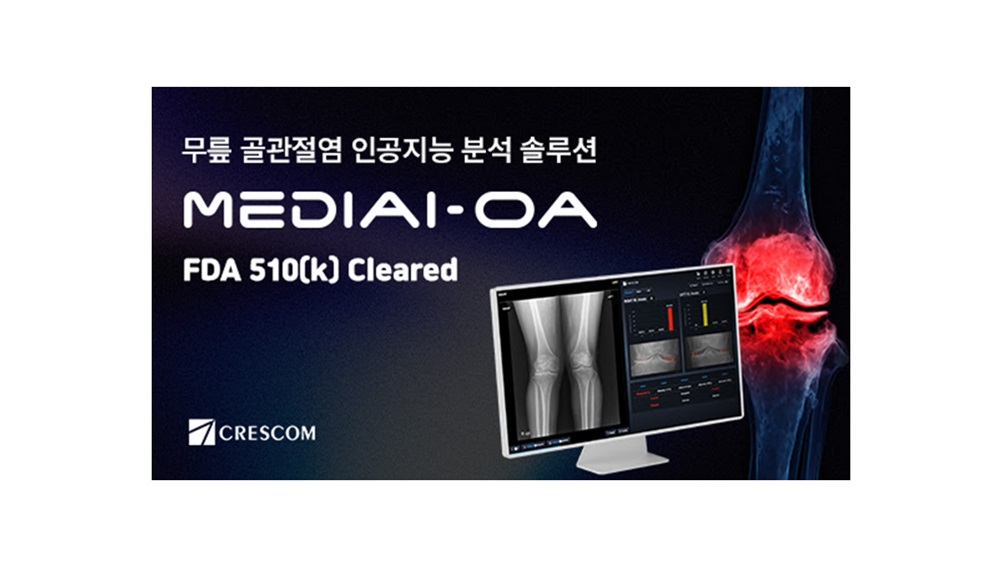 팝업내용 입력